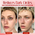 Seurico™ Instant Eye Bag Eraser