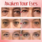 Seurico™ Instant Eye Bag Eraser