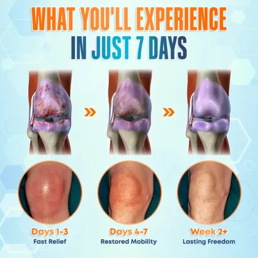 Seurico™ Premium Curcumin Pain Relief Gel