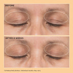 Neuropeptide Lift & Correct Duo