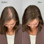 Kerarose™ Growth Support Shampoo